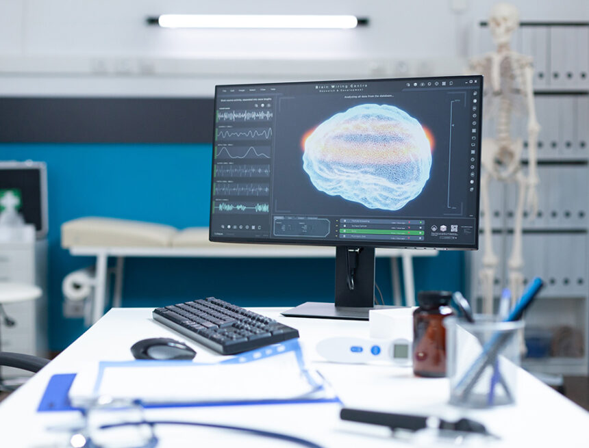 Empty examination office room having brain tomography on computer screen Бремя инсульта в Европе: анализ результатов Глобального исследования бремени заболеваний, полученных с 2010 по 2019 годы